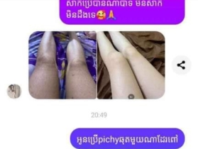 โลชั่นผิวขาว แบบเร่งด่วนเห็นผลจริง
